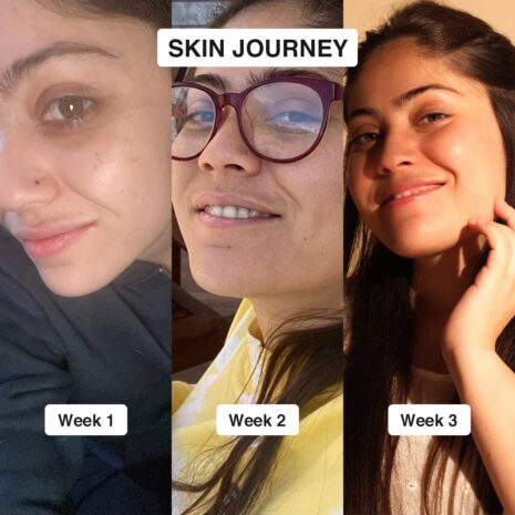 glowing-skin-with-vitamin-c-23-serum-30ml-advanced-molecular-skincare-technology-574156.jpg glowing-skin-with-vitamin-c-23-serum-30ml-advanced-molecular-skincare-technology-574156.jpg